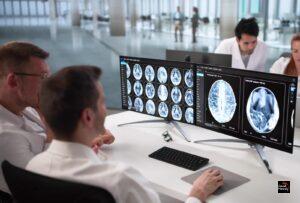 Huntington’s Disease Treated Successfully for the First Time